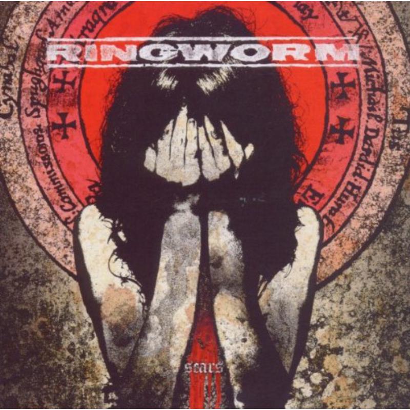 Picture of Ringworm - Scars