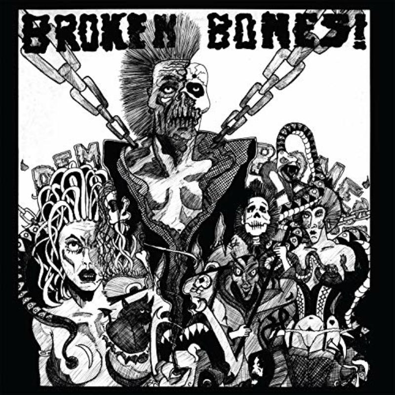 Picture of Broken Bones - Dem Bones