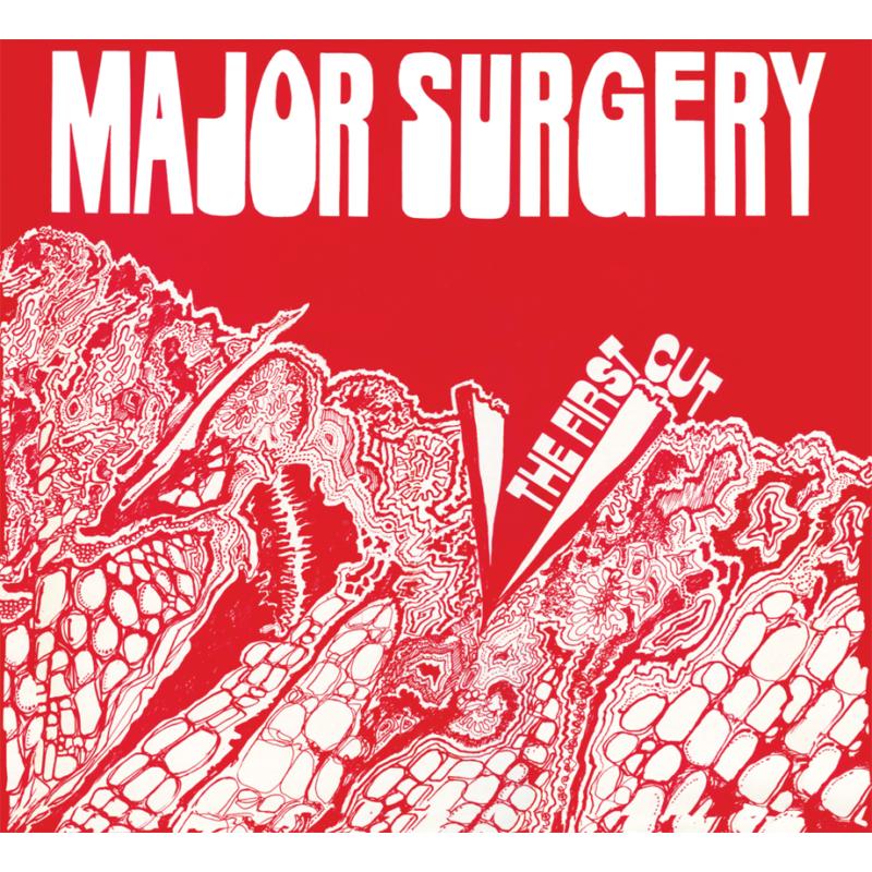 Picture of Major Surgery - The First Cut