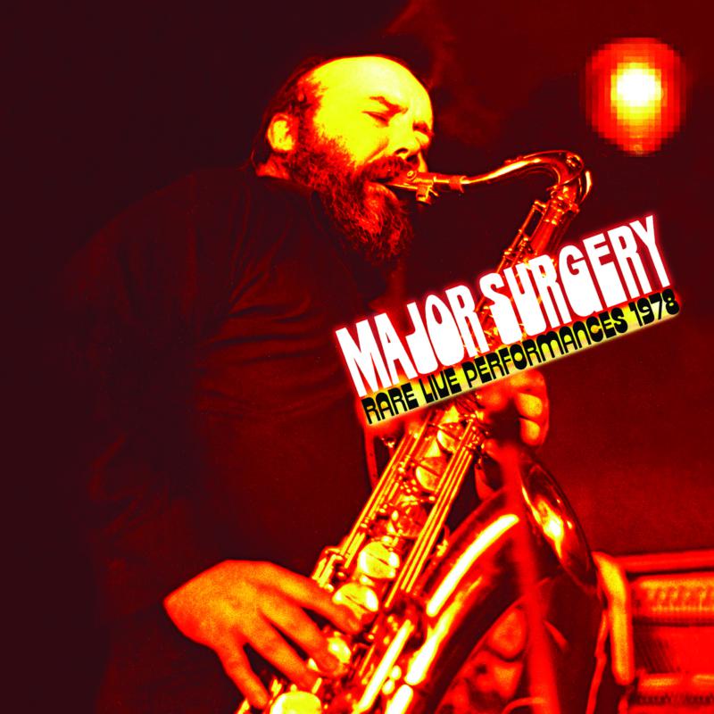 Picture of Major Surgery - Rare Live Performances 1978