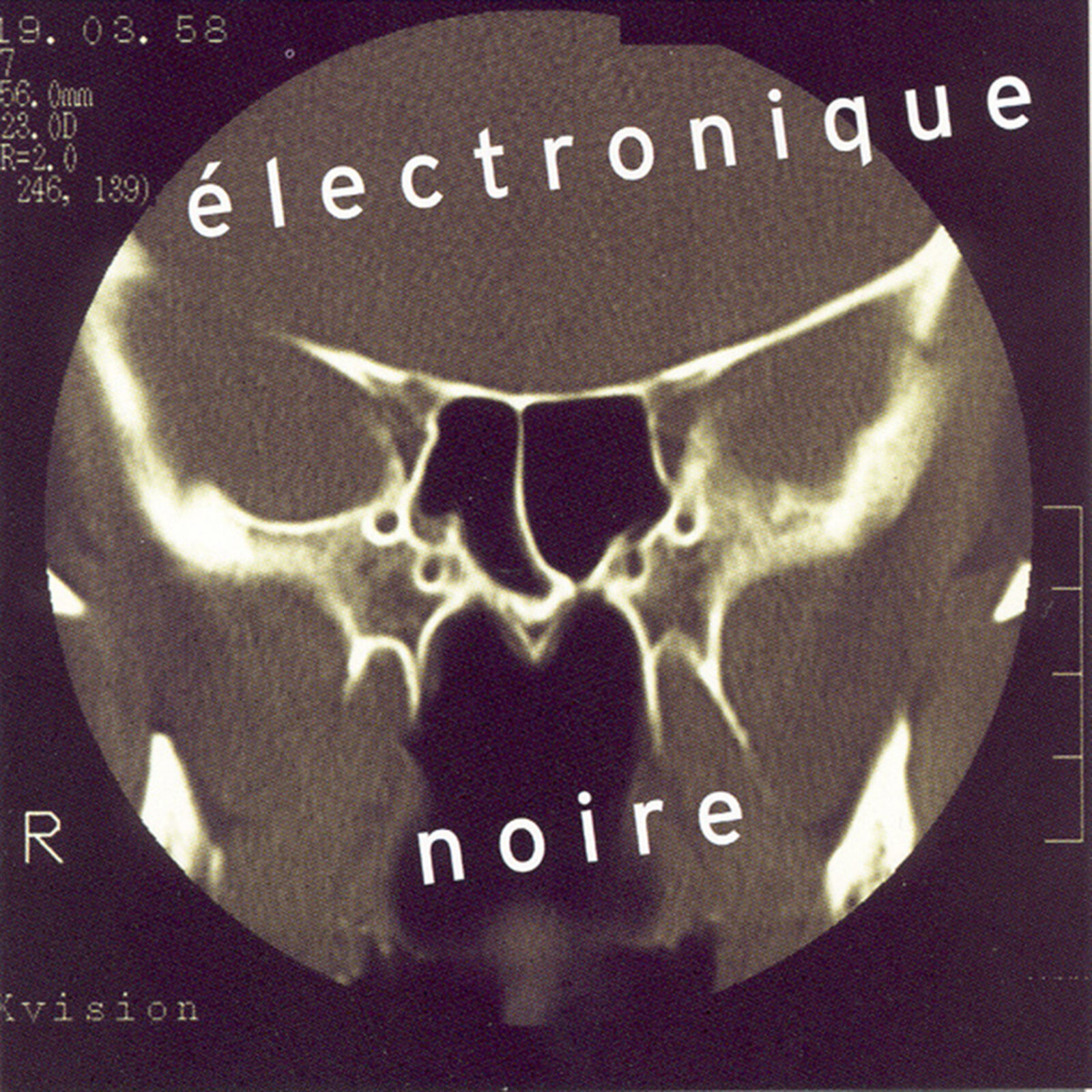 Picture of Eivind Aarset - Electronique Noire